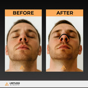 Black Limit Neus Strips